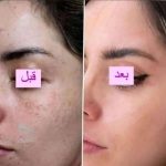 کرم اماراتی