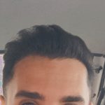 کاشت مو و ابرو  شیراز بصورت شرایطی