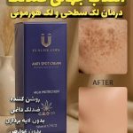 کرم ضد لک لاکچری کوئین