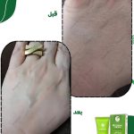 کرم جوان ساز دست و پا