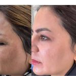 کرم ضد لک لاکچری کوئین