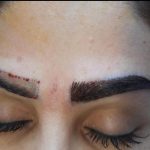 کاشت مو و ابرو در شیراز بصورت شرایطی