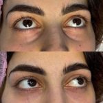 🌟 زیبایی طبیعی شما در دستان ماست! 🌟 رفع کامل چروک با بوتاکس | حجم‌دهی حرفه‌ای لب و گونه