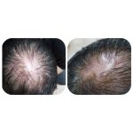 تونیک تقویت مو آریا