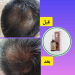 تونیک تقویت مو آریا