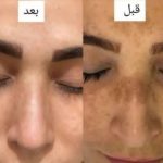 روغن طبیعی و معجزه آسای بادام شیرین