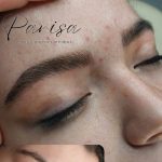 میکرو کرکی مویی