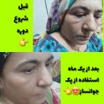 سرم جوانساز سلول های بنیادی گل رز