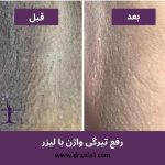 مشاوره و رفع تیرگی