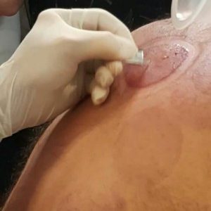 همایش دوره تخصصی حجامت درتهران