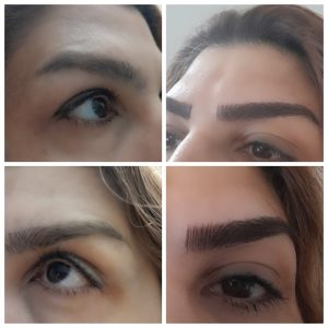 میکروبلیدینگ باکمترین هزینه