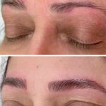میکروبلیدینگ ومیکروپیگمنتیشین