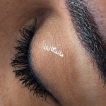 کاشت‌ اکسیشن مژه