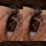 کاشت‌ اکسیشن مژه